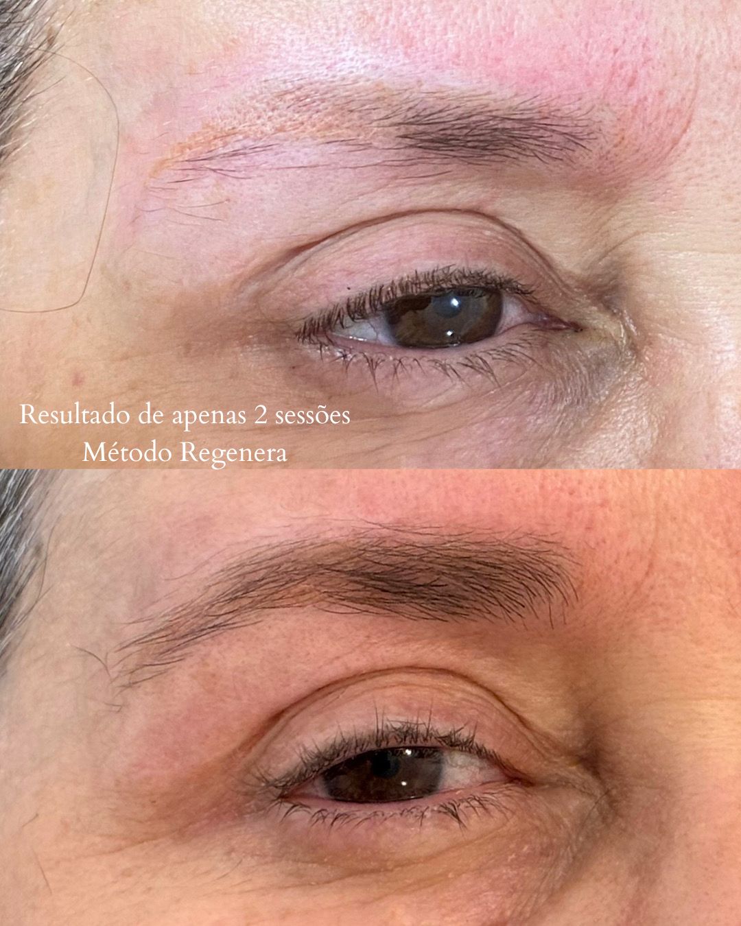 Antes e depois — Resultado em apenas 2 sessões