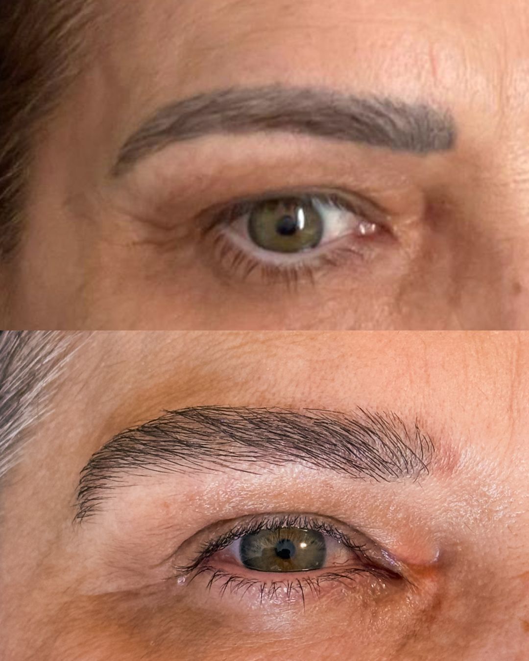 Antes e depois — Densidade e desenho restaurados